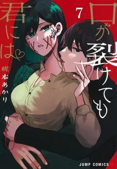 Kuchi ga Saketemo Kimi ni wa (Serialization)